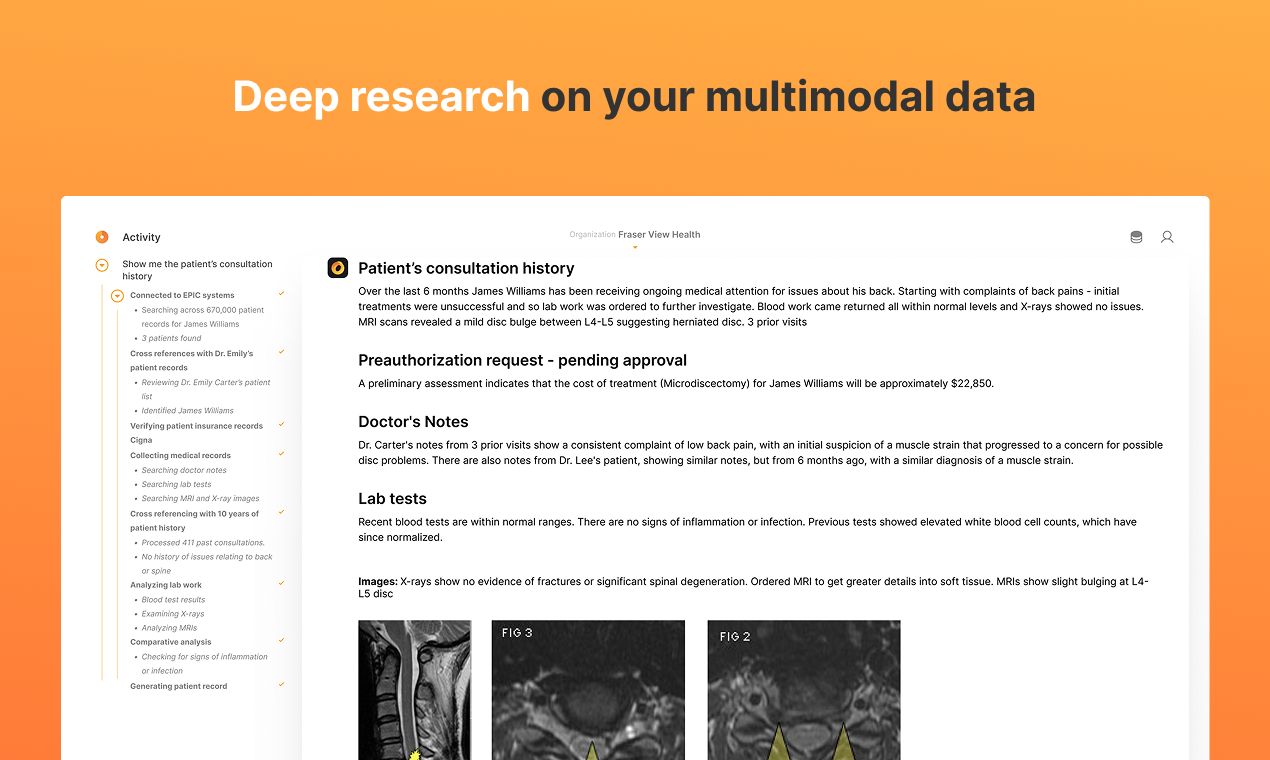 利用 Deep Lake 构建私有多模态数据之上的 Deep Research-4