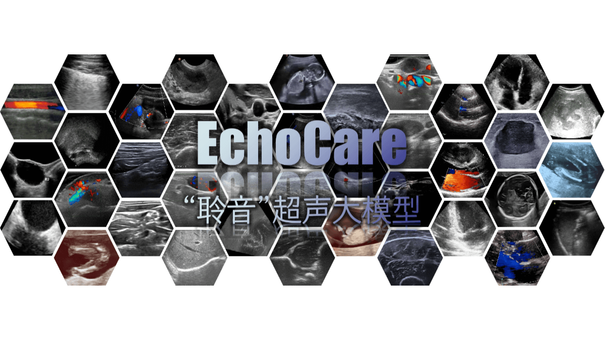聆音EchoCare - 香港科学院开源的超声基座大模型